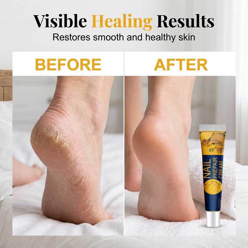 🦶 Foot Repair Cream – Moisturizing Care for Dry & Cracked Heels