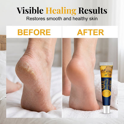 🦶 Foot Repair Cream – Moisturizing Care for Dry & Cracked Heels